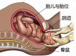 囟门在哪个位置示意图（囟门凹陷是营养不良吗）